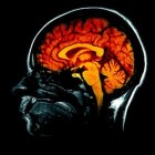 cerveau