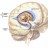 parkinsons-disease2