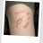 vaccin blog