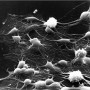 neurona