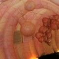 colon